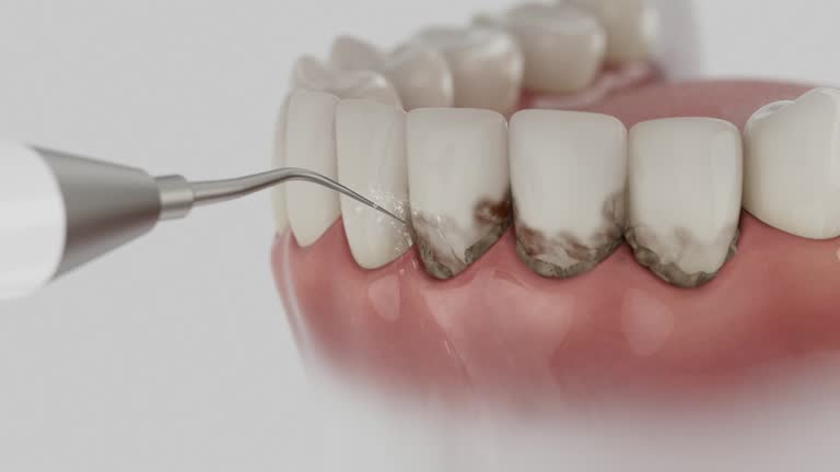 Reliable Teeth Cleaning And Checkup contractor in Etowah County County, AL by Dentist Open Now